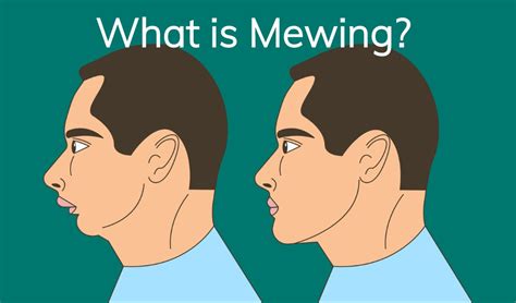 what does the term mewing mean